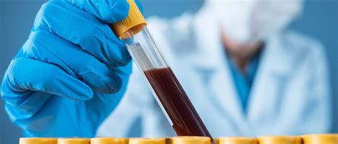 blood test drop in liverpool|private blood tests liverpool.